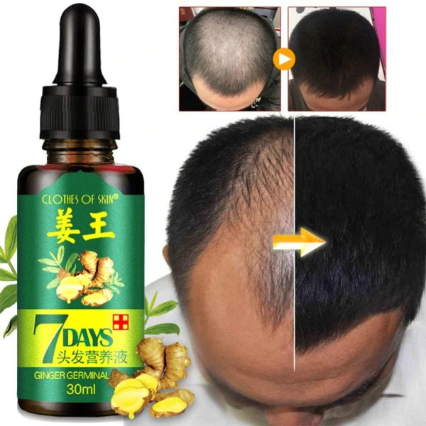 7 Day Ginger Germinal Oil
