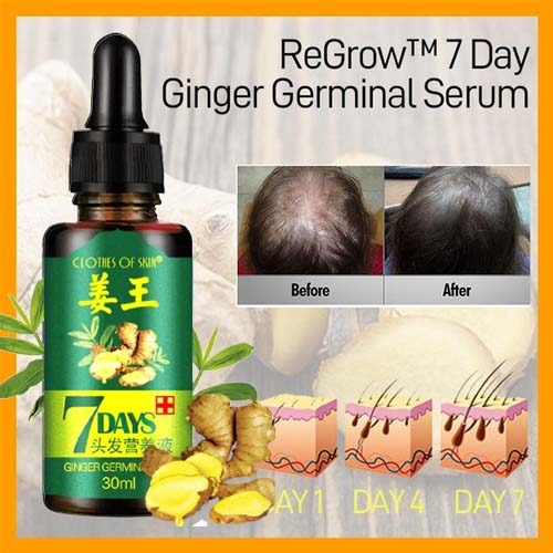 7 Day Ginger Germinal Oil