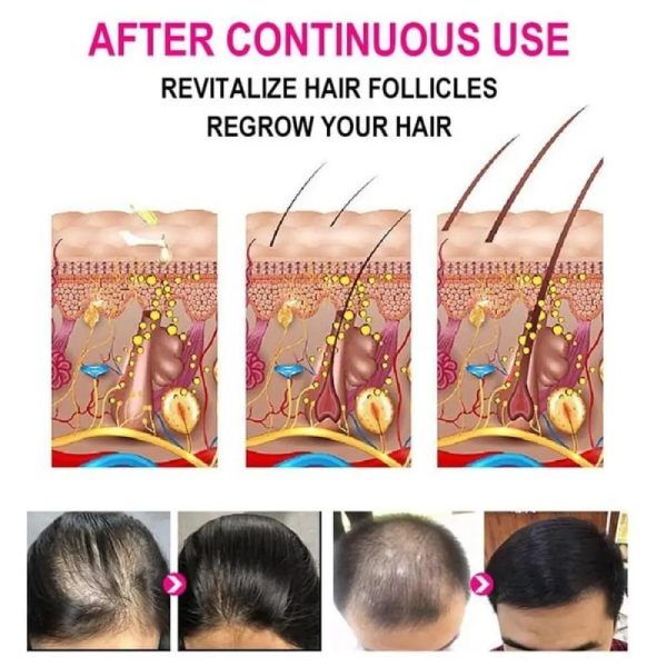 Anti-greying Ganoderma Hair Serum